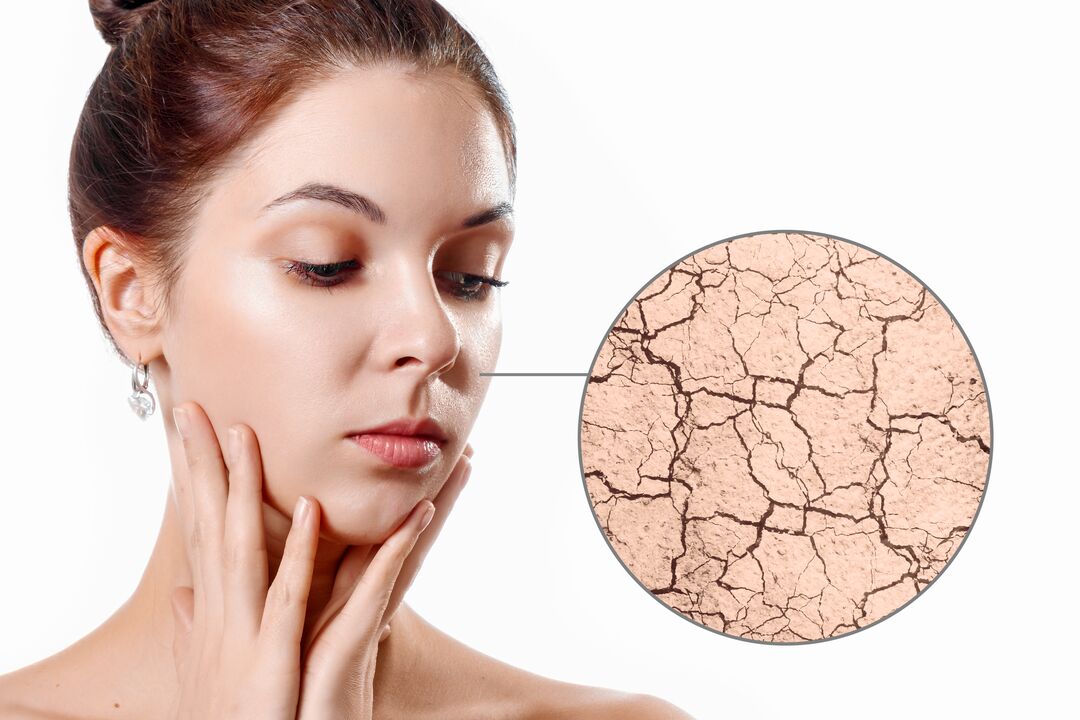 Moisturiséiere trocken Haut mat Eudalie Creme